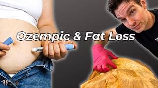 What Ozempic &amp Weight Loss Drugs Really Do to the Body
